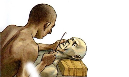 Removal of the Brain