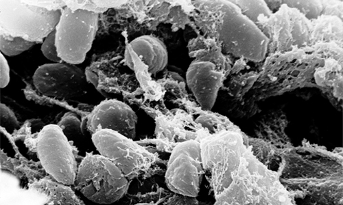 bacterium-Yersinia-pestis