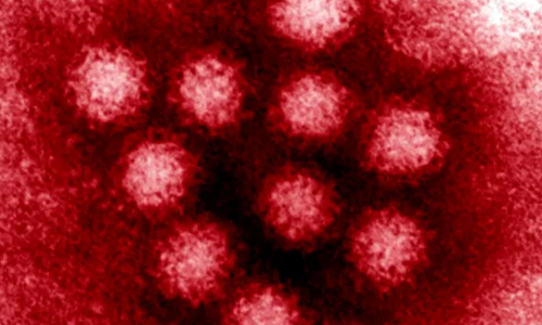  Does Sanitizer Kill Norovirus