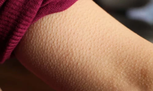 When It’s Cold