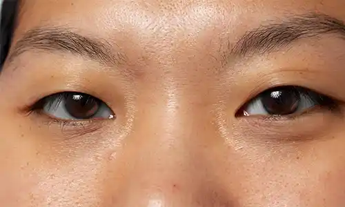  Hooded Eyes