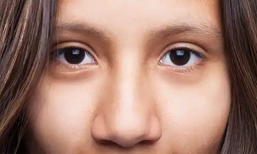 Monolid Eyes