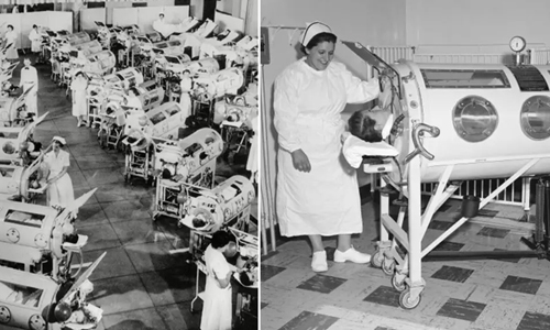 Evolution of the Iron Lung