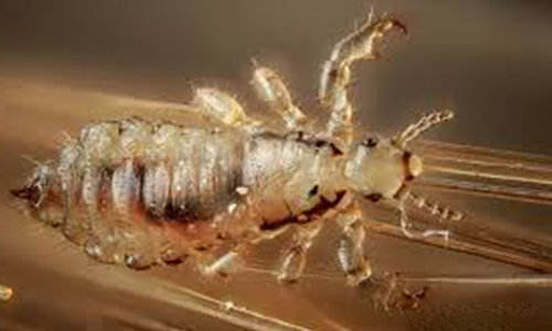 Head-lice 
