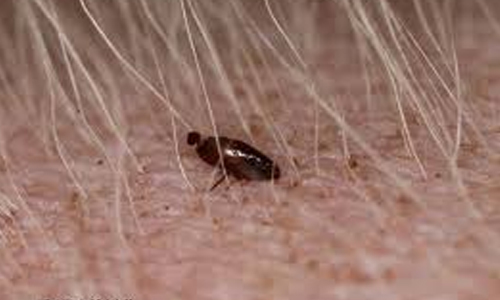 How Fleas Looks Like? 